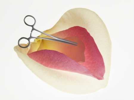 Të fiksuara pas kirurgjisë plastike, femrat kërkojnë të "zbukurojnë" vaginën Të fiksuara pas kirurgjisë plastike, femrat kërkojnë të "zbukurojnë" vaginën